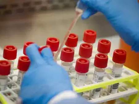 753 new corona positives found in Jaipur district today