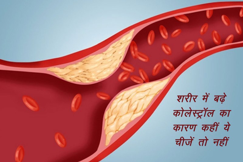 high cholesterol, high cholesterol diet, high cholesterol food items, high cholesterol level, bad cholesterol, bad cholesterol foods, high cholesterol foods not to eat, high cholesterol foods to avoid, processed meat, ये चीजें बढ़ाती हैं कोलेस्ट्रॉल