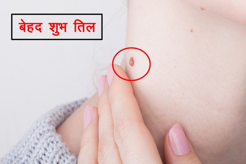 samudrik shastra, lucky moles, lucky moles on body, lucky moles on female body, lucky moles on male body