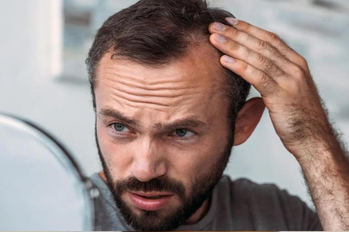 baldness_in_men_causes_and_prevention.jpg
