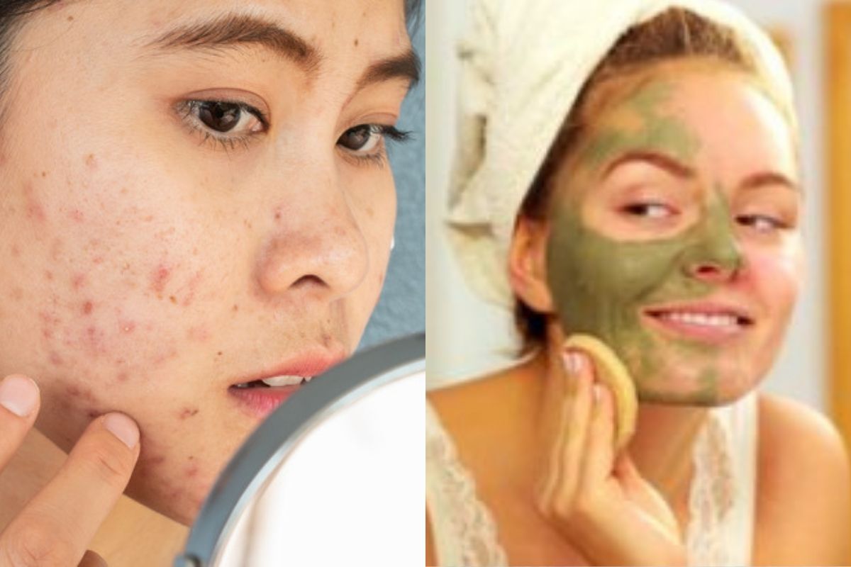 curry_leaves_will_remove_blemishes_and_pimples_from_the_skin.jpg