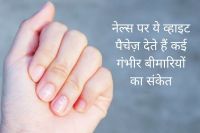 white_marks_on_the_nails_cause_of_deficiency_of_liver-_kidney_and_minerals.jpg