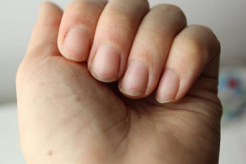Home Remedies for Nails: अगर आप भी नाखूनों की गंदगी और पीलेपन से परेशान हैं और इससे छुटकारा पाना चाहते हैं तो तुरंत आजमाएं ये घरेलू नुस्खे