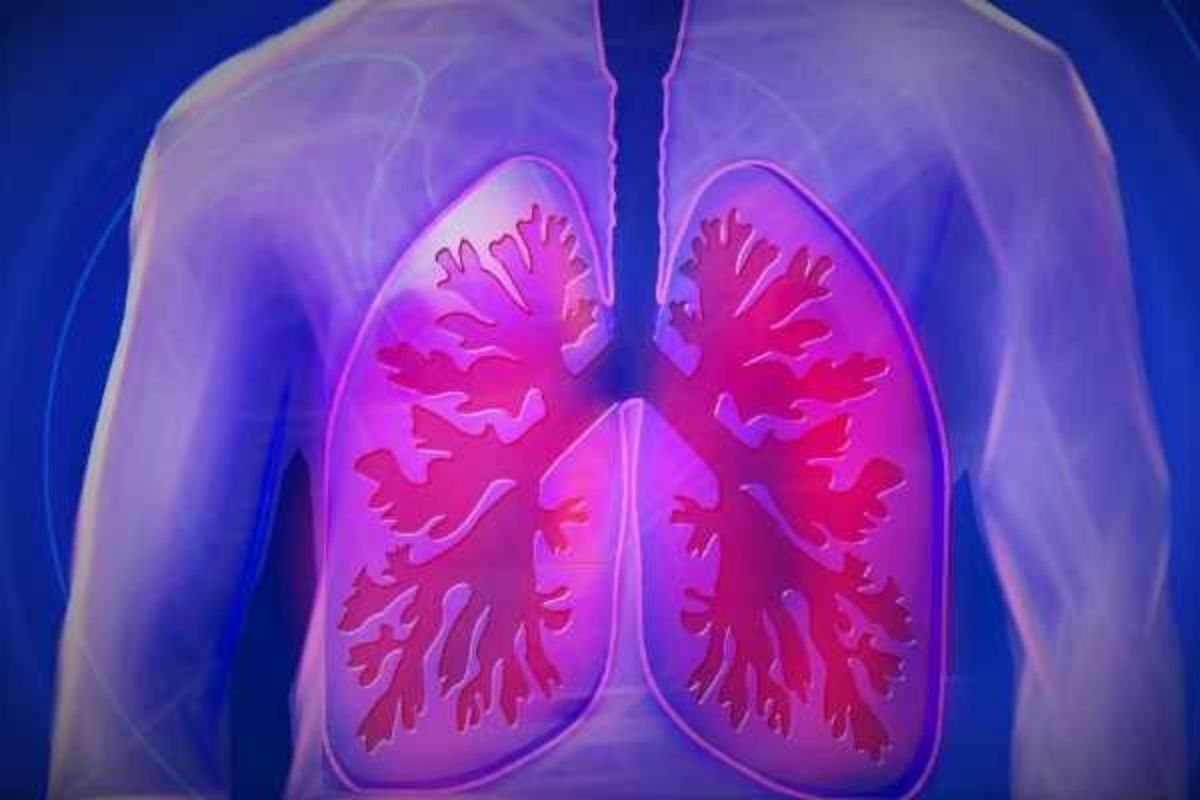 lungs_problem-_respiratory_disease_will_be_treated_with_ras_cell.jpg