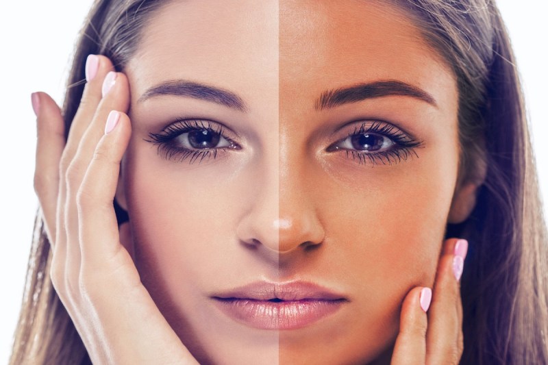 गर्मियों की वजह से हो गई है स्किन टैनिंग, तो इससे छुटकारा पाने के लिए आजमाएं ये घरेलू उपाय