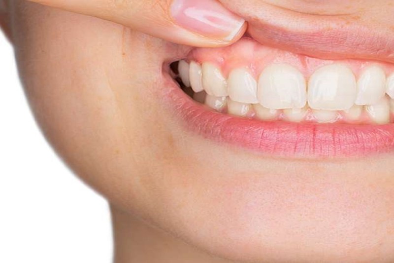 Oral Health: खराब ओरल हेल्थ से रहते हैं परेशान तो सांस संबंधी समस्याओं से लेकर डायबिटीज तक की हो सकती है समस्या, जानिए