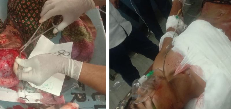 फसल निकालते थ्रेसर की चपेट में आई युवती, मशीन में आने से युवक का हाथ कंधे से हुआ अलग