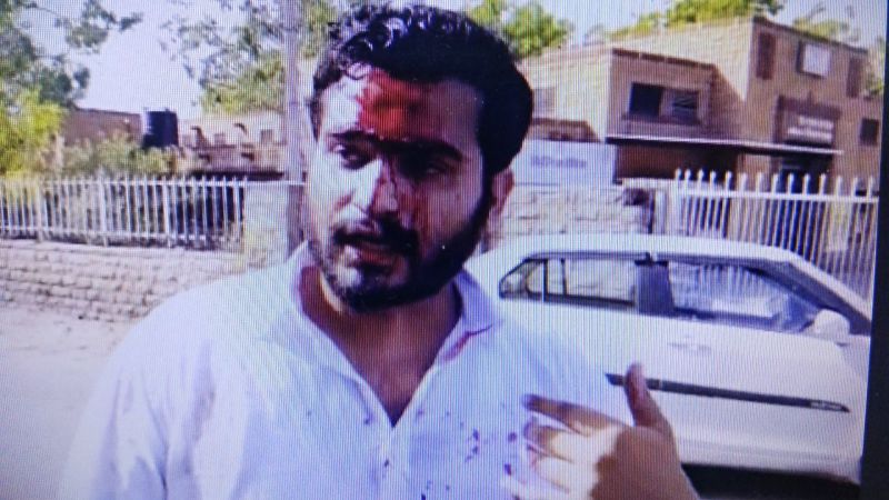 पथराव से युवक के सिर से बह रहे खून के बीच कह डाली ये बड़ी बात, देखें video... 