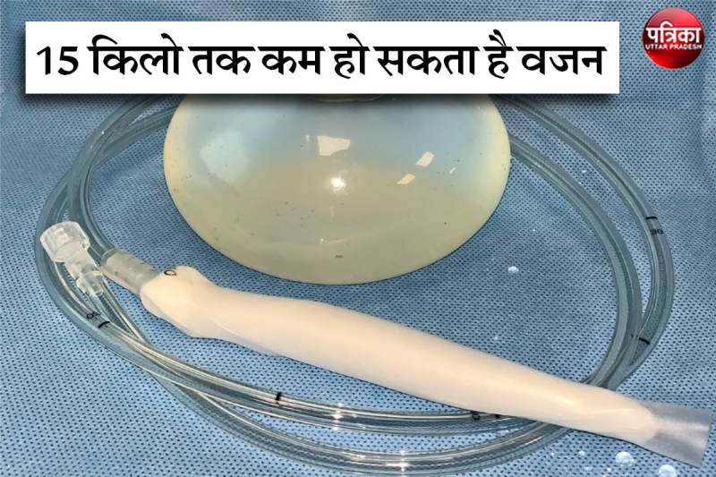 Intra Gastric Polymer Balloon for Weight Loss know How