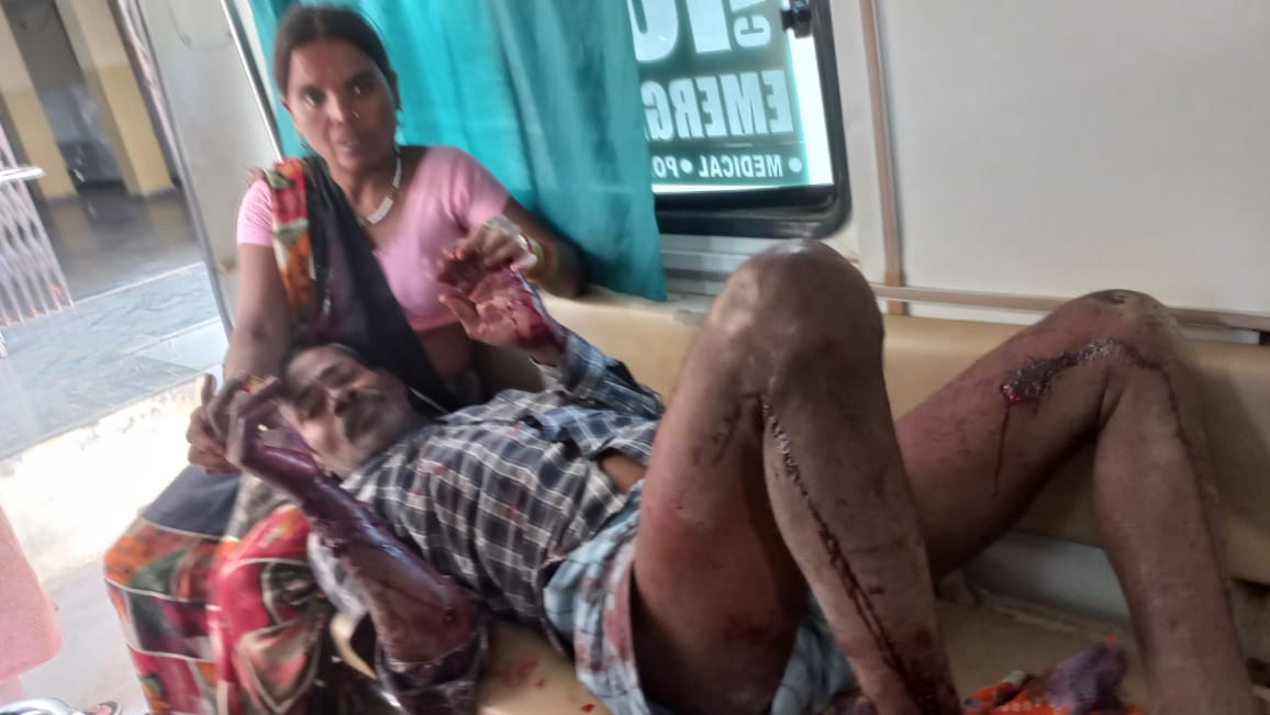 लकड़बग्घे के हमले से घायल