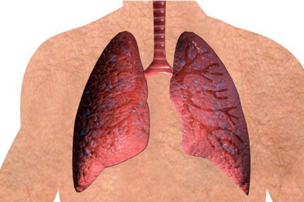 food_keeps_clean_lungs_healthy_naturally_phlegm-cough_expelling_tips.jpg