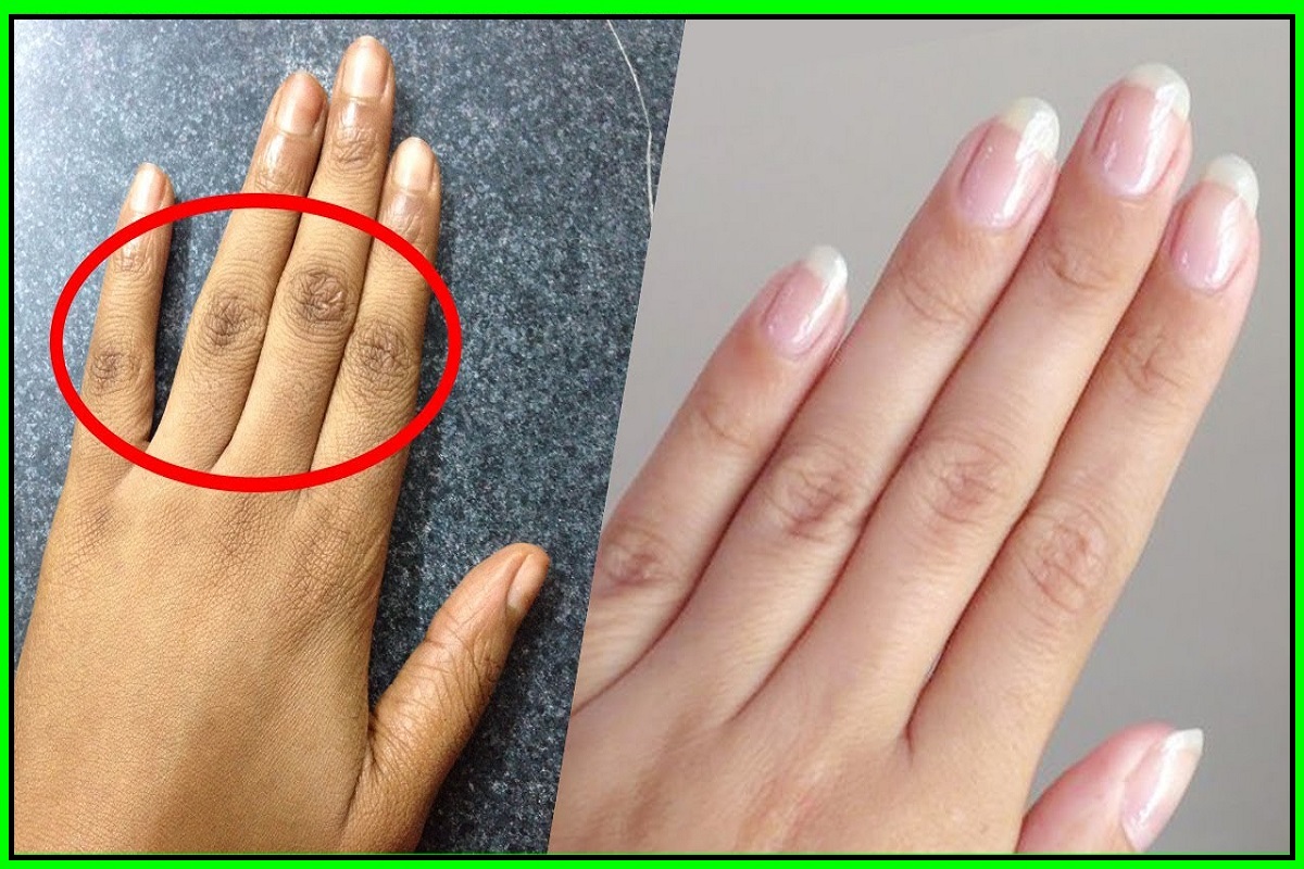 उंगलियों के जोड़ों के कालेपन को कम करने के लिए अपना सकते हैं घरेलू उपायों को