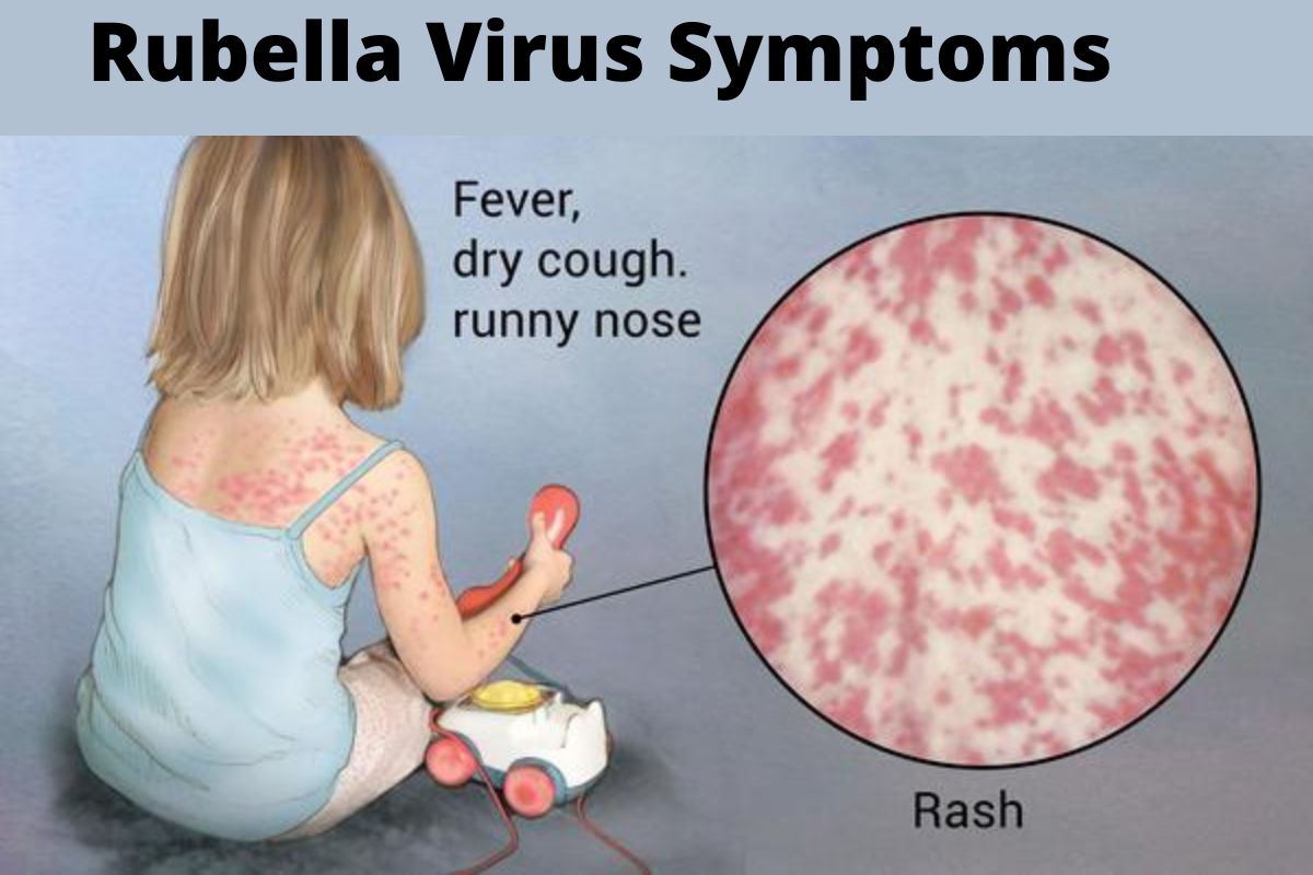 rubella_virus_symptoms_treatment_causes_in_hindi_what_is_rubella_virus.jpg