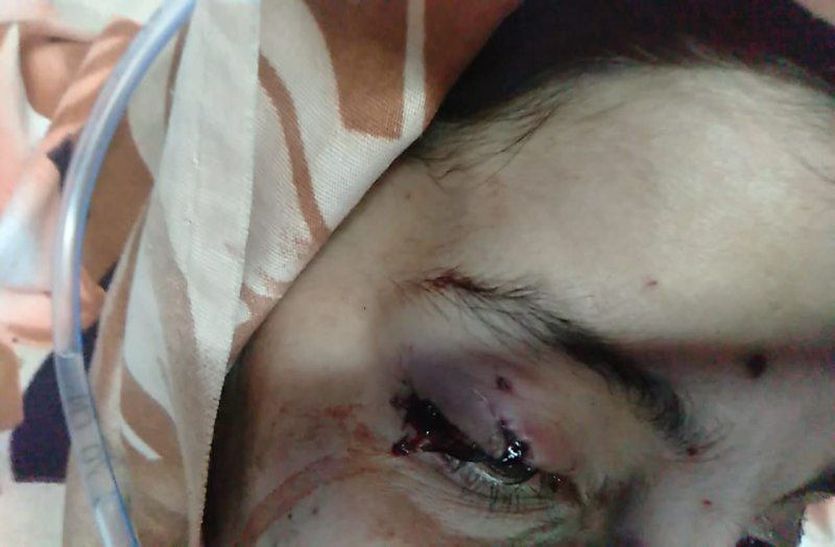 राज्य मानवाधिकार आयोग ने दिया आदेश, लकवाग्रस्त महिला को दिए जाएं 50 हजार रुपए