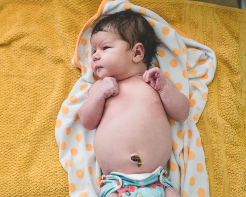 गन्ने के खेत इस हालत में पड़ी मासूम के लिए रिक्शा चालक बना मसीहा