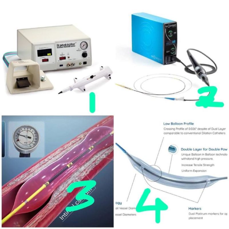 70 साल के बुजुर्ग के दिल की धमनियों में जमे कैल्शियम का इलाज