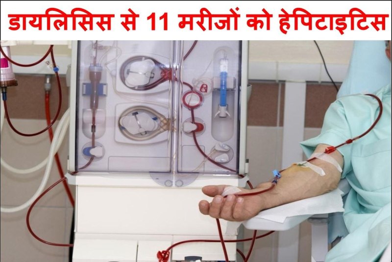 11 Hepatitis patients Found After dialysis at Ursala Hospital in Kanpur