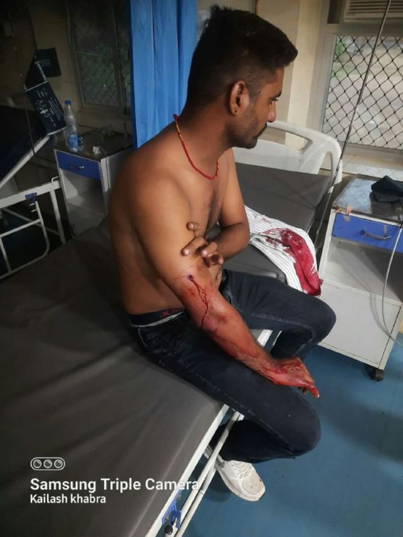 Gun shot : मामूली विवाद में युवक पर गोली चलाई, यहां लगी गोली