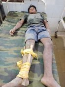 Here the raw wall collapsed during the construction of the building, o