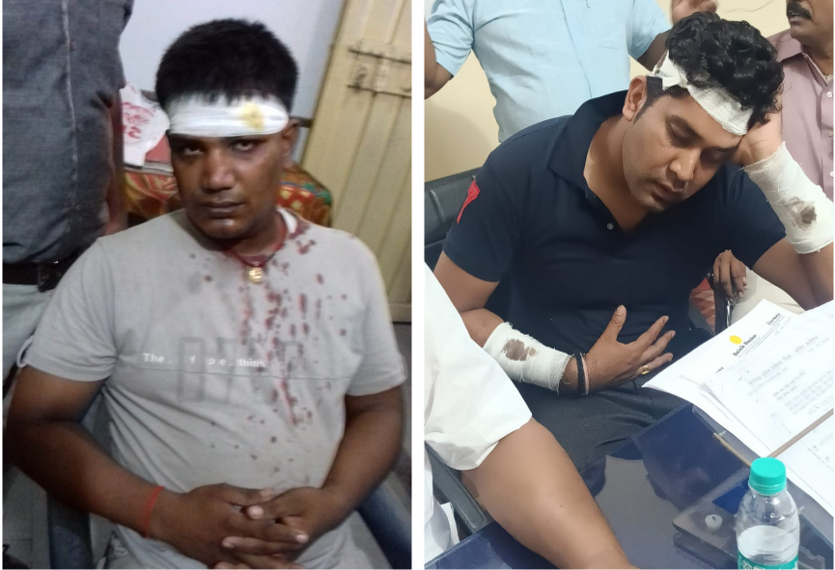 Beaten between BJP-Congress leader: