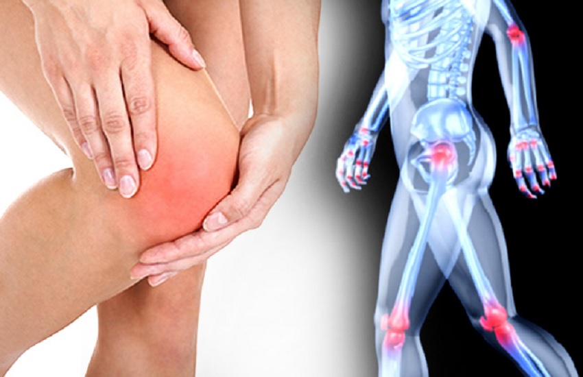 arthritis patients (symbolic photo)