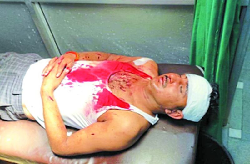 राजस्थान में पुलिस के पीछे भगाए पिटबुल डॉग, चार जवान घायल