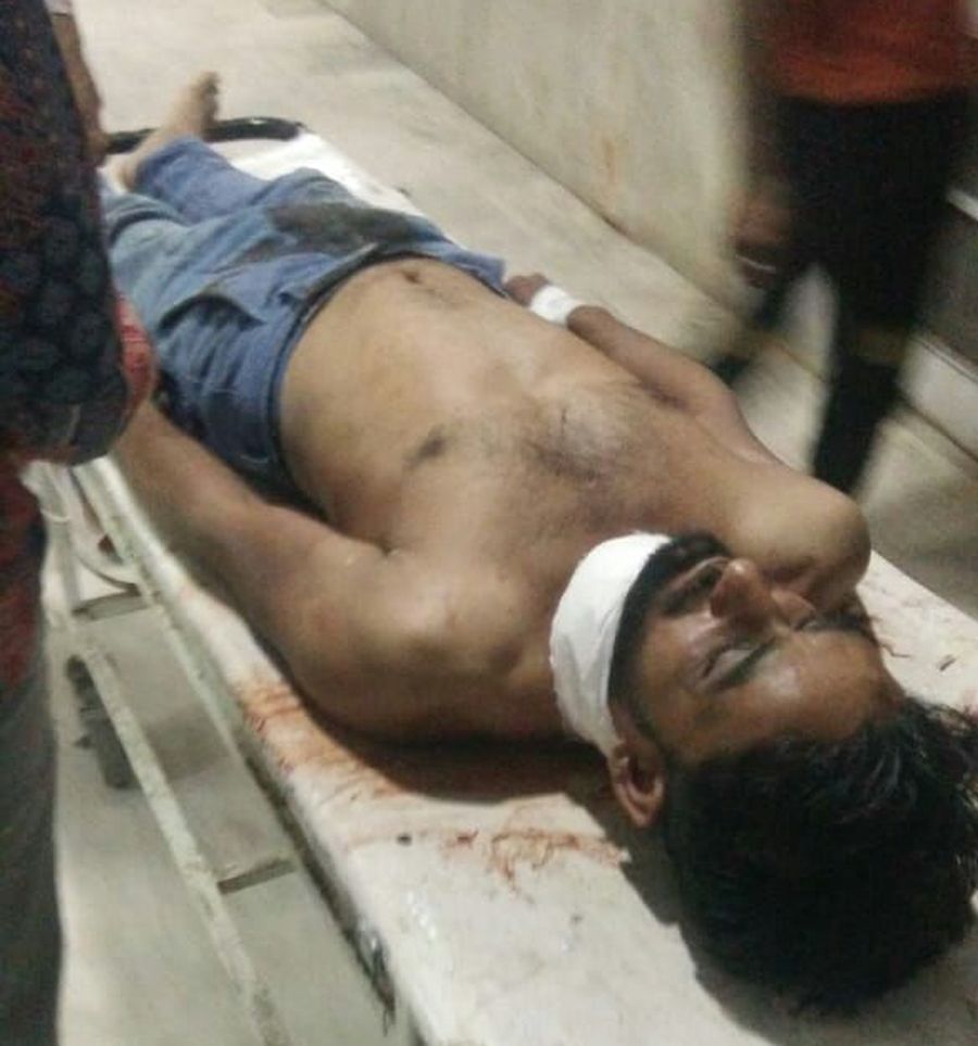 Attempt to murder : चाकू से युवक के गले पर जानलेवा हमला