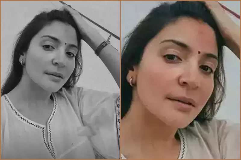 is anushka sharma injured netizens think there is bruise on actress forehead