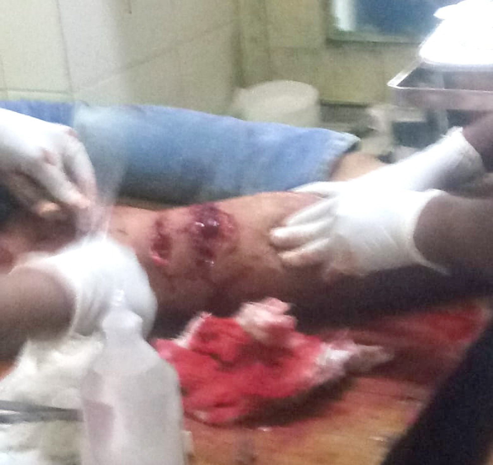 पर्यटन स्थल माउंट आबू में बंदरों ने हमला कर एक दर्जन लोगों को किया जख्मी, अस्पताल पहुंचाया