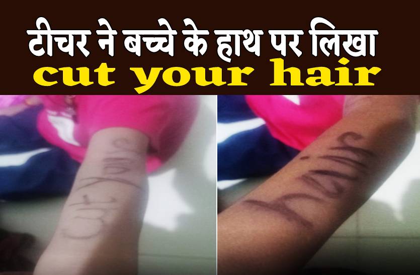 इंदौर में टीचर ने नर्सरी के बच्चे के हाथ पर मार्कर से लिखा cut your hair, हंगामा