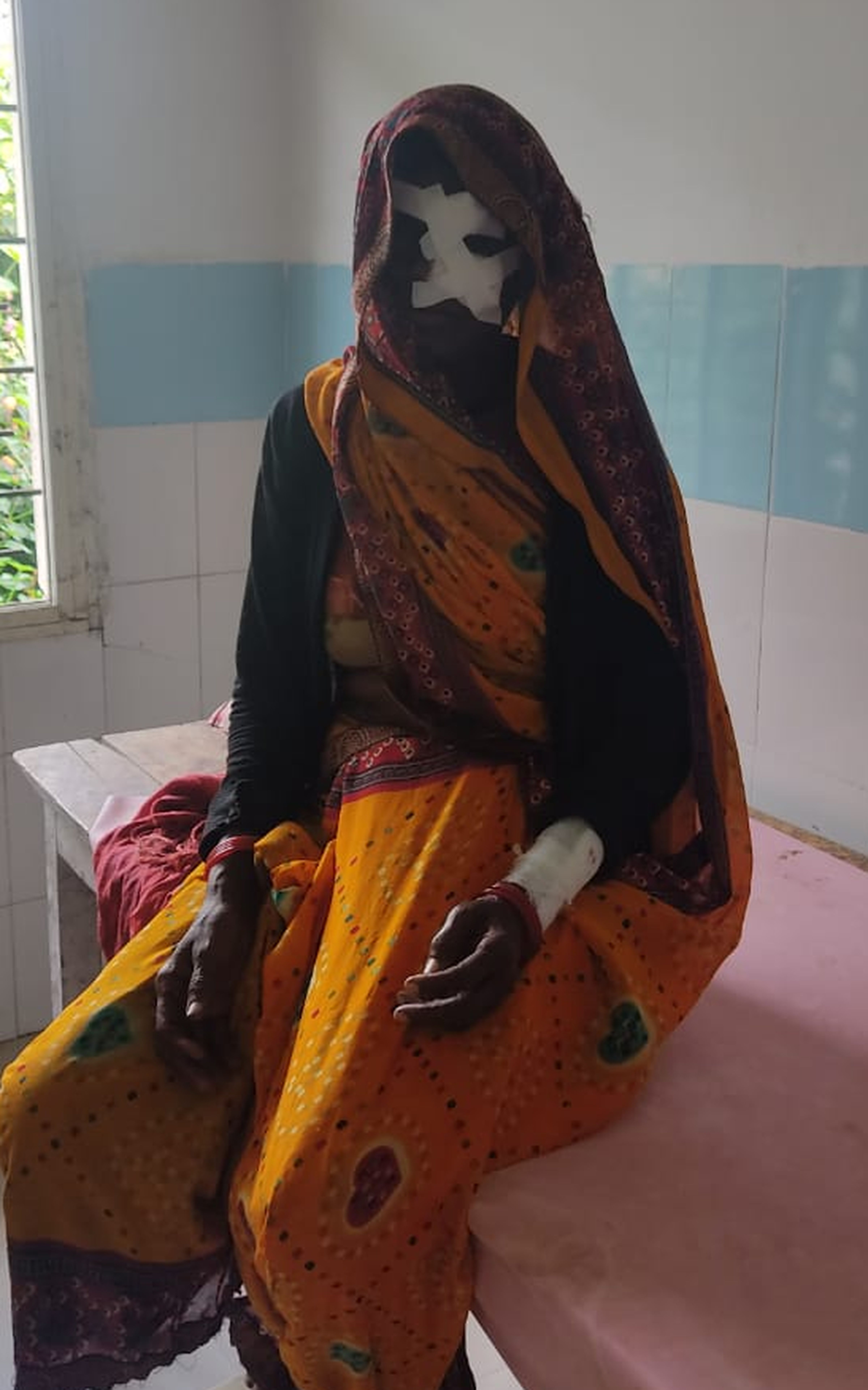 बकरियां चराने गई महिला पर किया तेंदुए ने हमला