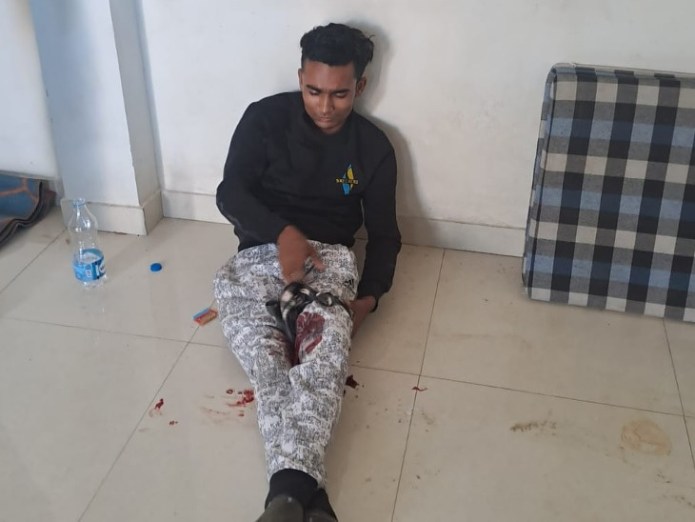 Gangster's operation in SMS hospital, condition out of danger