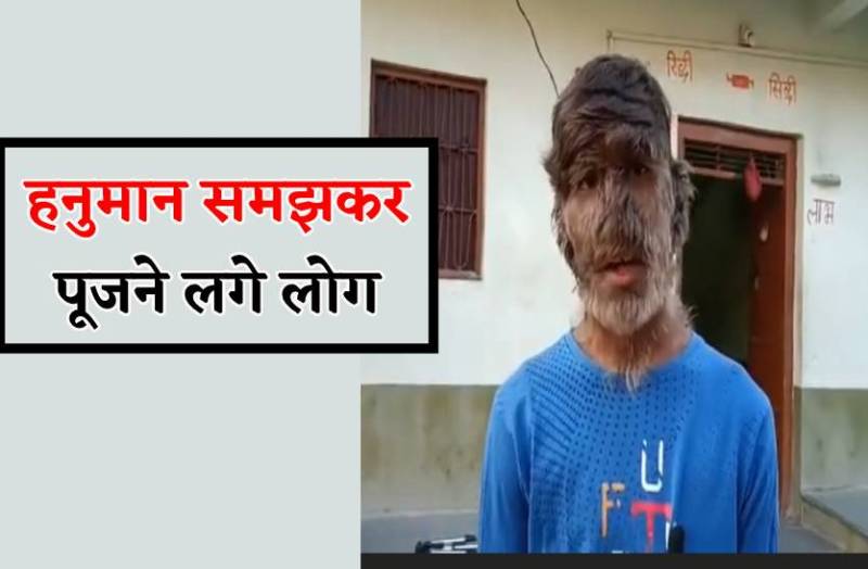 चेहरे पर लंबे बाल-पहले पत्थर मारते थे लोग, अब करने लगे हैं पूजा, बोलते हैं हनुमान