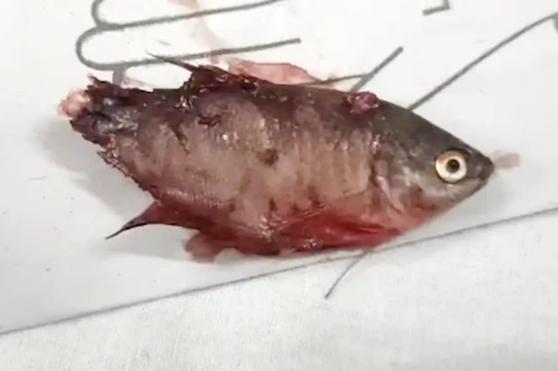 Child dies after fish gets stuck in his throat in Thane