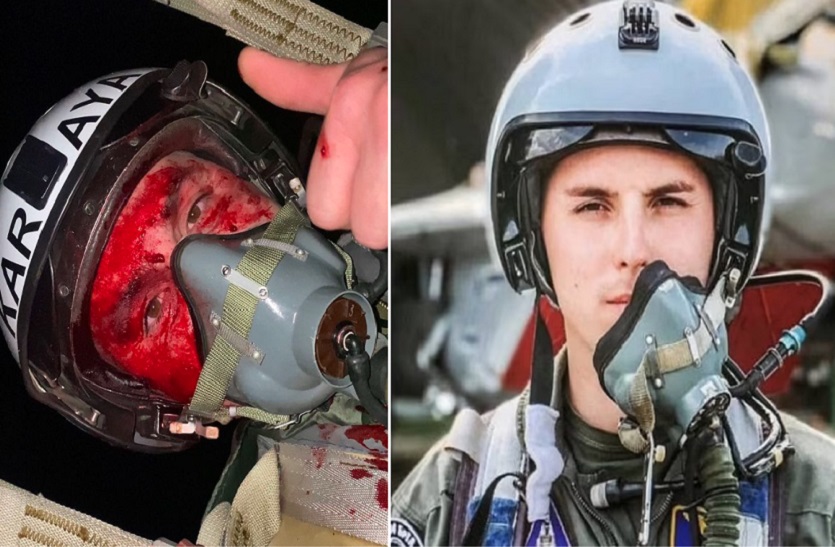 Russia-Ukraine War: Pilot ने डाली थी खून से लथपथ Selfie, जेलेंस्की ने दिया 'हीरो ऑफ यूक्रेन' का सम्मान