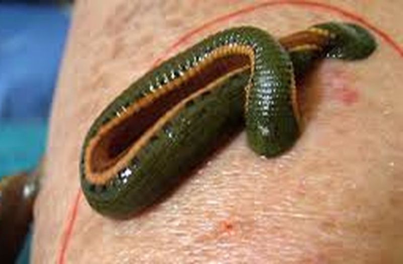 Leech not only sucks blood but is helpful in treating many diseases