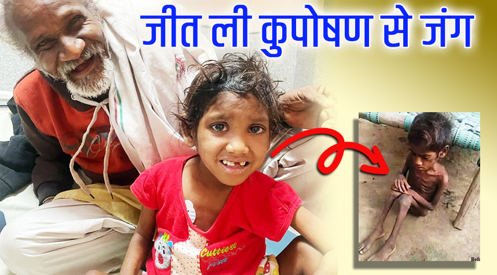 सोमवती की रातों का सबेरा हुआ, कुपोषण से जीती जंग मोतियाबिंद भी जाता रहा