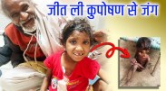 सोमवती की रातों का सबेरा हुआ, कुपोषण से जीती जंग मोतियाबिंद भी जाता रहा