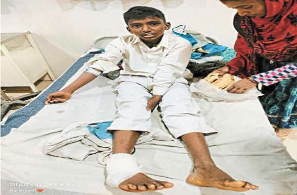 छिंदवाड़ा में तीन का गला कटा, एक का पैर