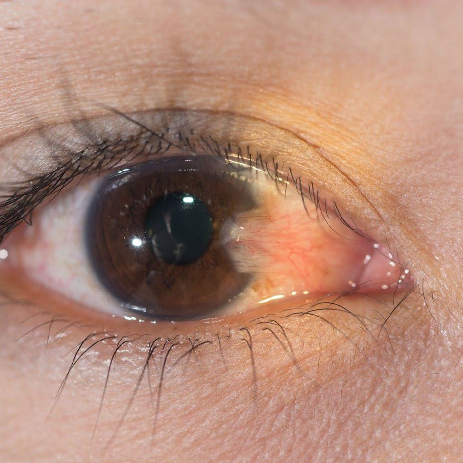 EYE--- प्रदेश में 8 करोड़ की जनता पर 287 नेत्र सहायक