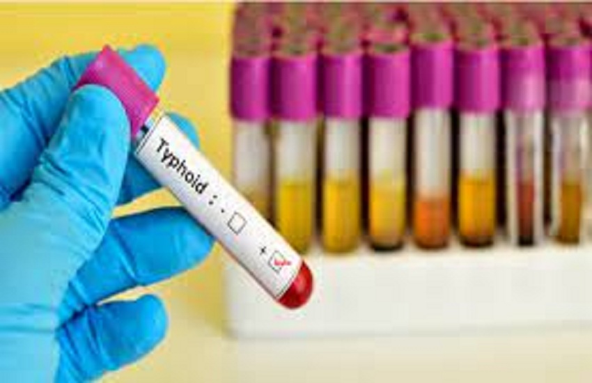 अहमदाबाद में 21 दिन में जलजनित रोगों के 473 मरीज