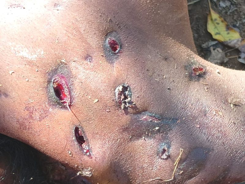 Wild animal attacked the farmer, scratched half his body