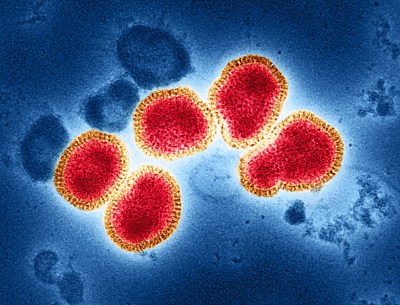 H3N2 influenza