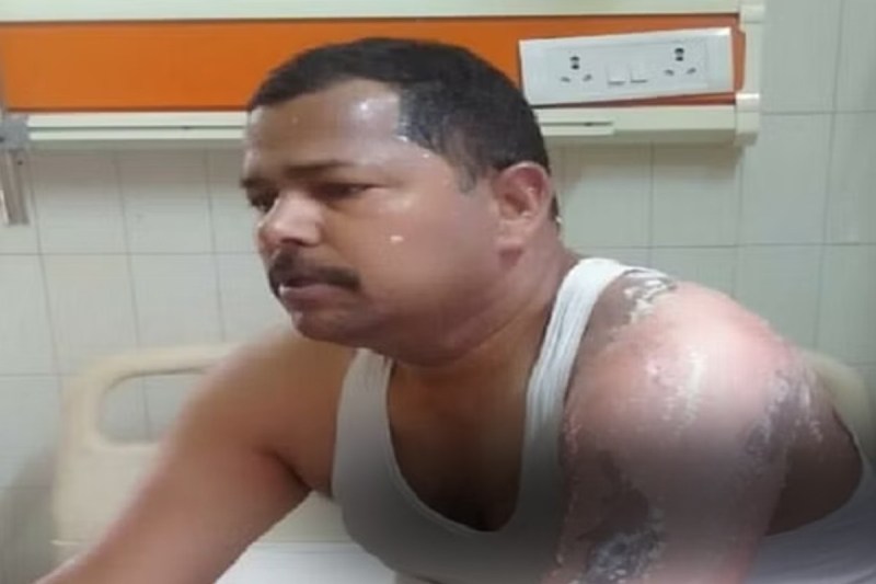 basti_police.jpg Basti news Explosion on burning garbage, police man scorched in fire