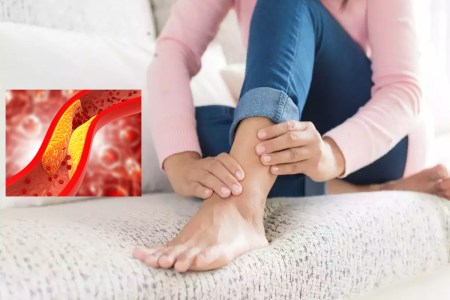 cholesterol.jpg