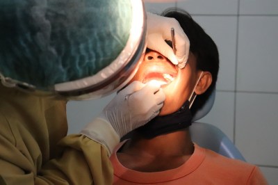 drymouth2.jpg