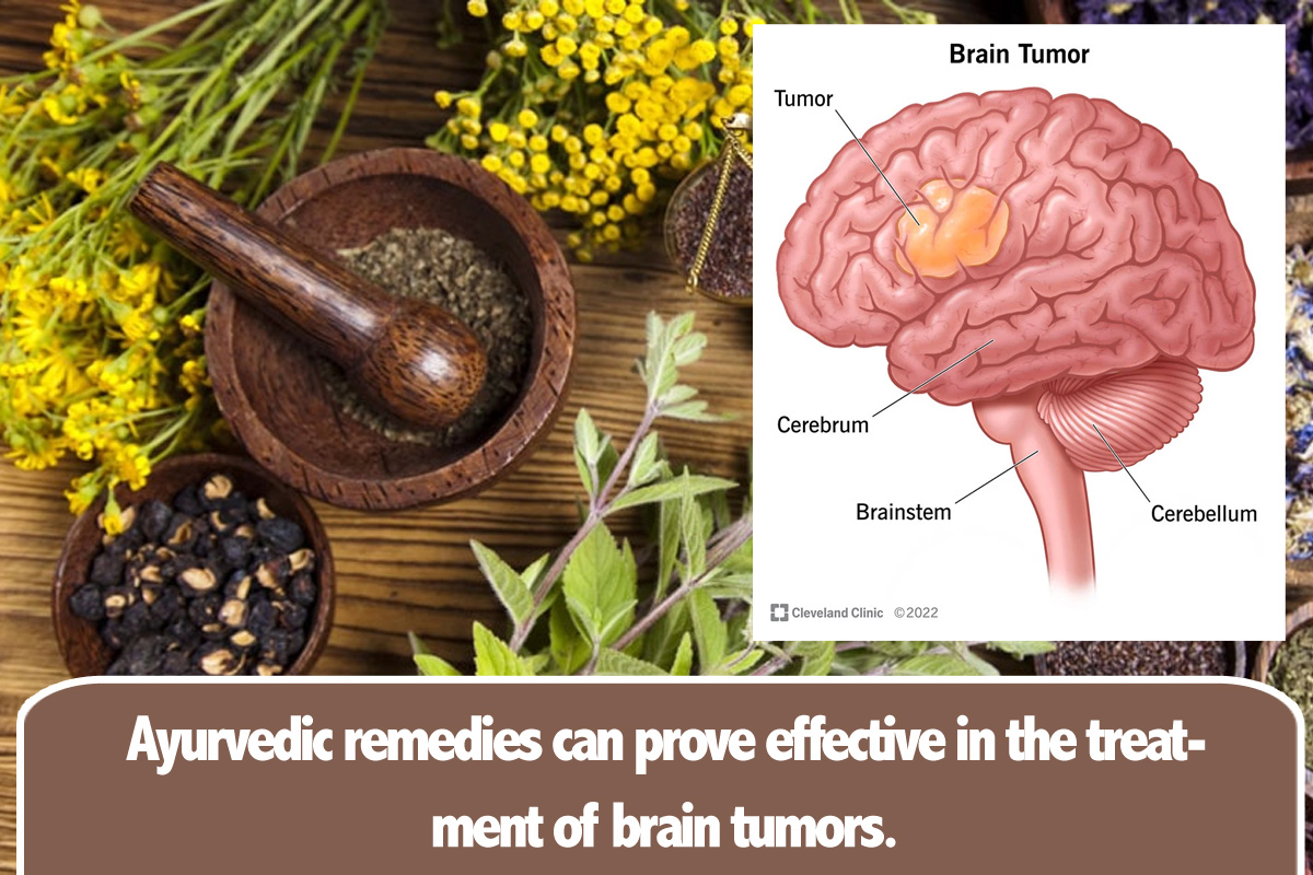 brain-tumor-remedy.jpg
