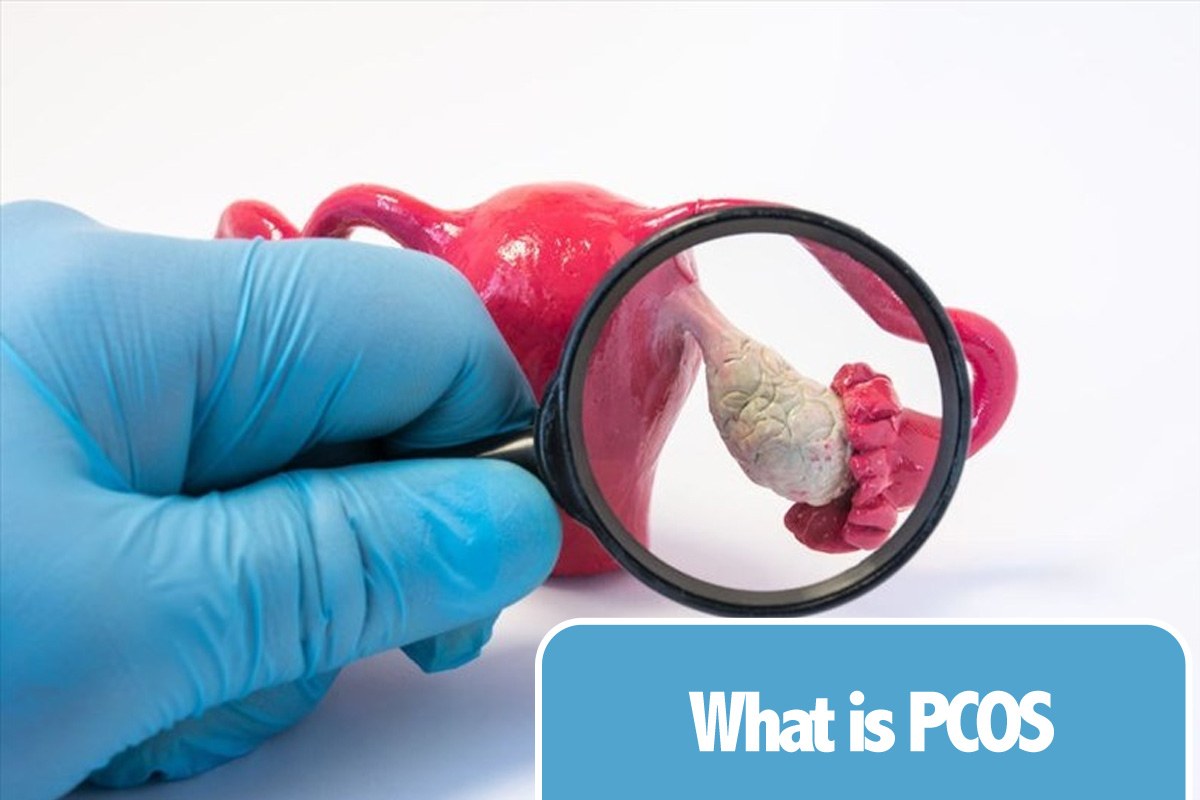 polycystic ovarian syndrome (PCOS) 