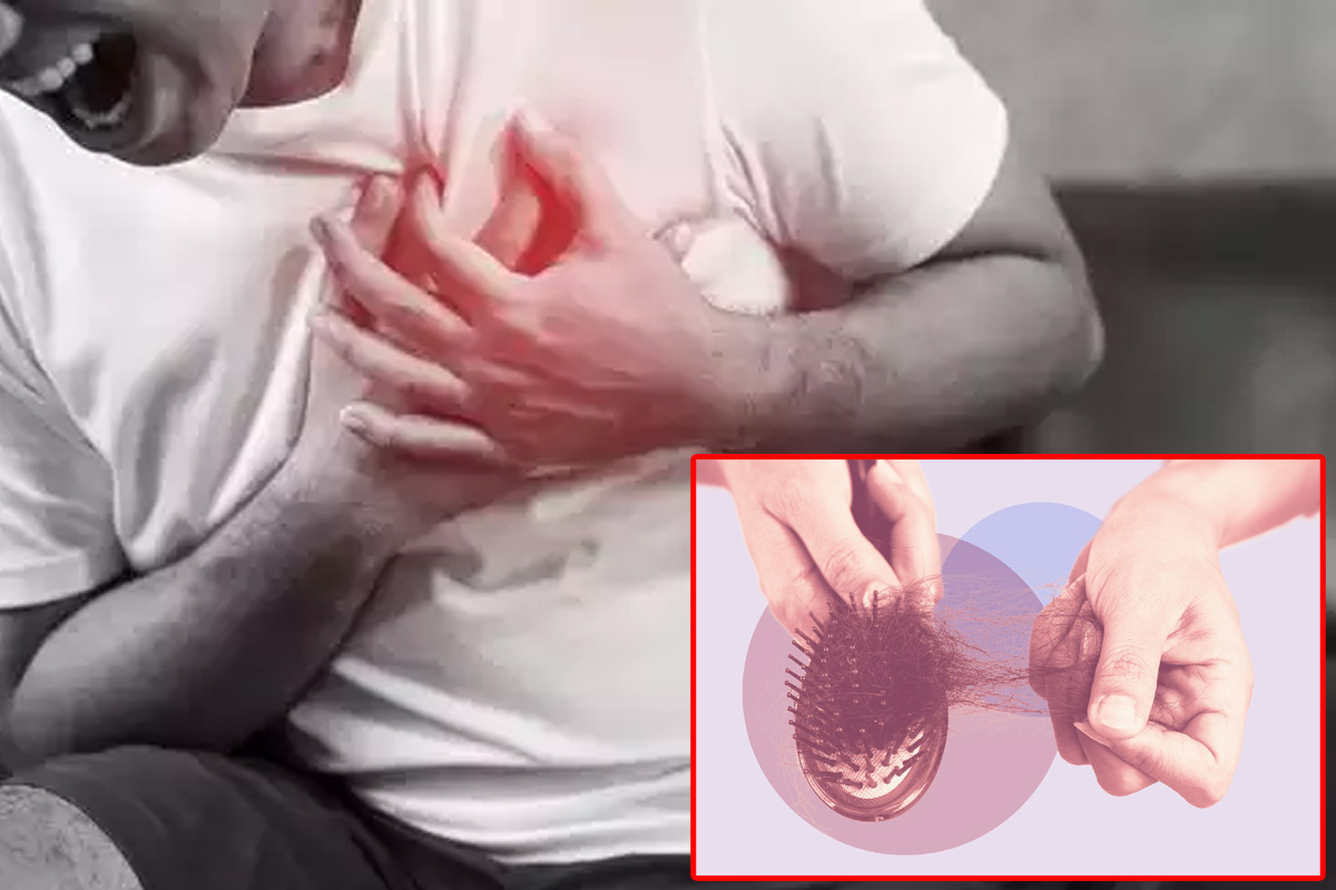 Such changes happen in the hair of the head before the heart attack