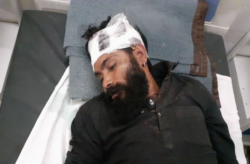 #Ratlam दुकान में घुसकर युवक पर हमला किया, सिर में चाकू मारे